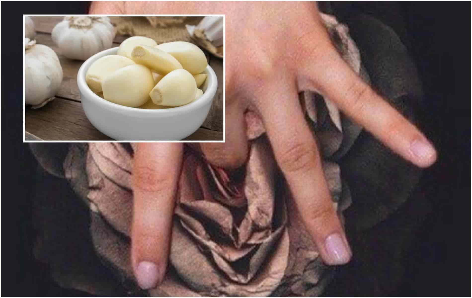 ¿Ajo en la vagina? Los mitos y realidades ¿Ajo en la vagina? Los mitos y realidades