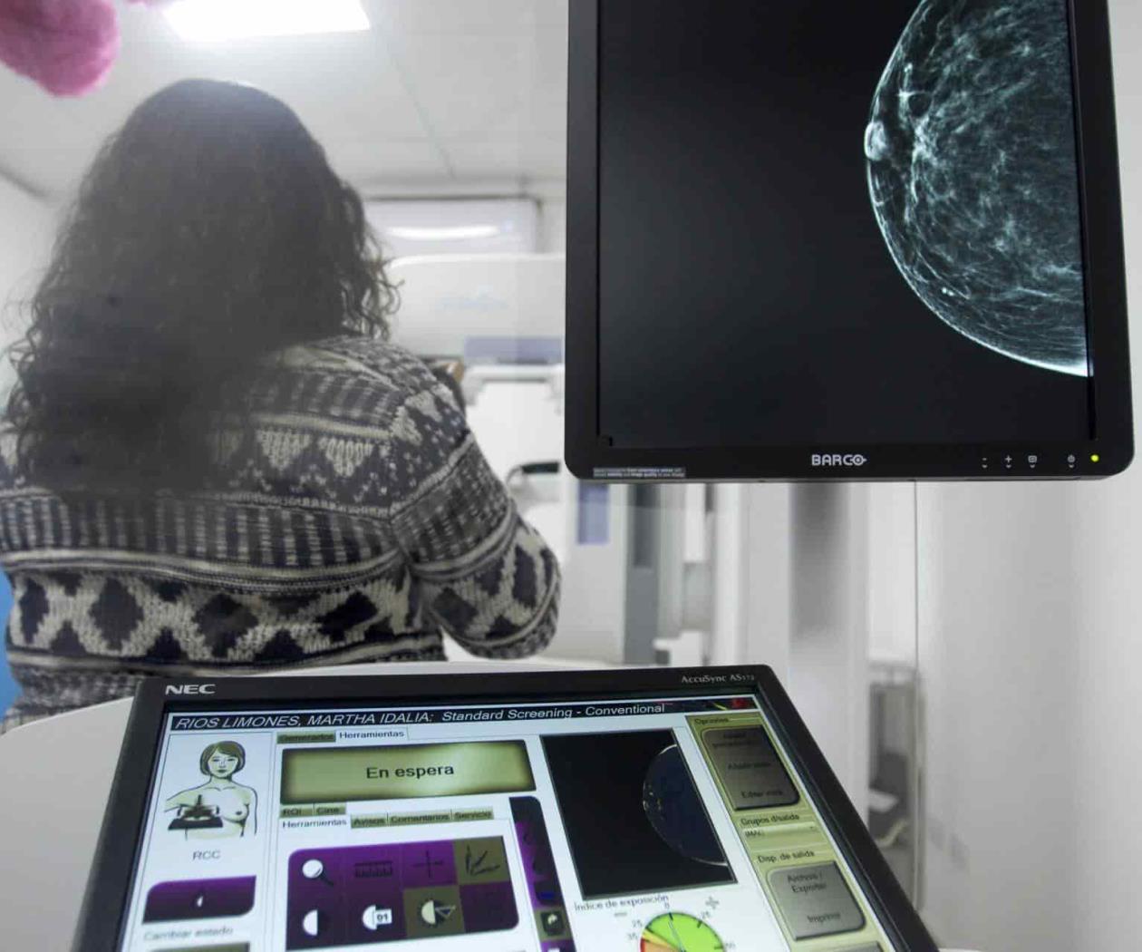 Dejan de realizarse mastografías y papanicolau en pandemia