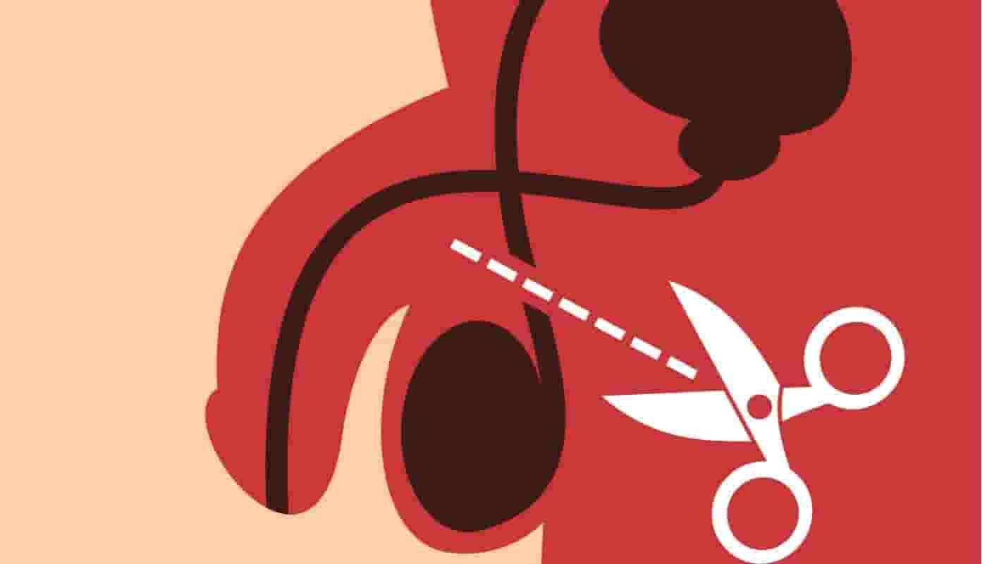 La vasectomía y la lucha contra el machismo La vasectomía y la lucha contra el machismo