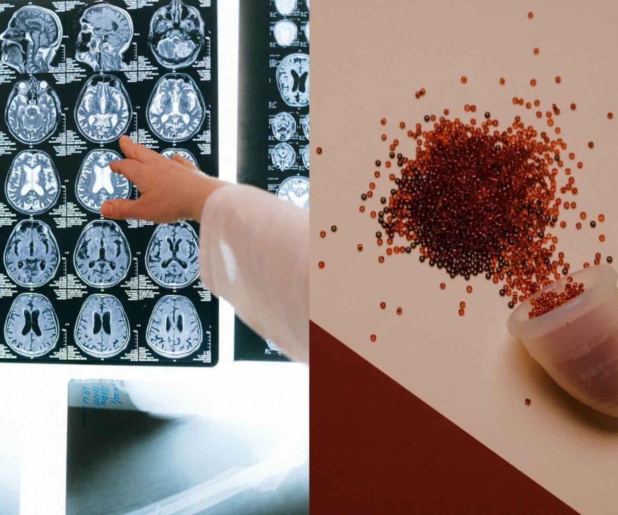 ¿Qué cambios ocurren en el cerebro durante la menstruación?