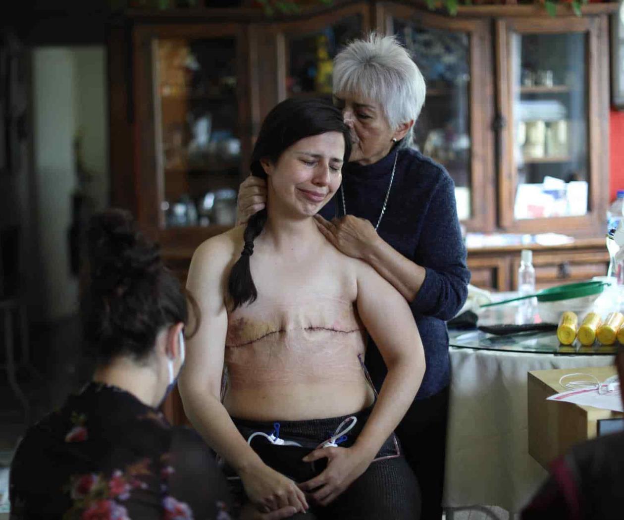 "Jódete cáncer", una iniciativa para empoderar a mujeres sin senos "Jódete cáncer", una iniciativa para empoderar a mujeres sin senos