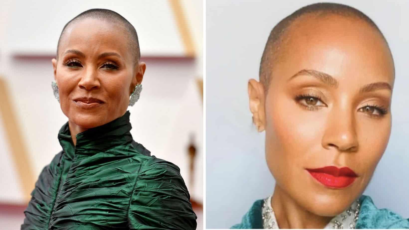 Jada Pinkett, esposa de Will Smith, ayuda a mujeres negras a vivir con alopecia Jada Pinkett, esposa de Will Smith, ayuda a mujeres negras a vivir con alopecia