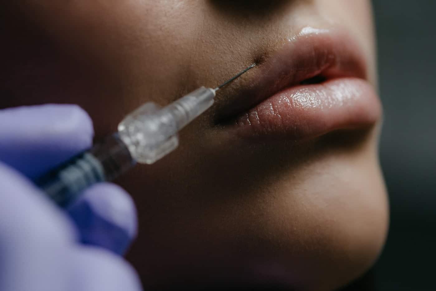 La belleza: causa de violencia estética contra las mujeres La belleza: causa de violencia estética contra las mujeres