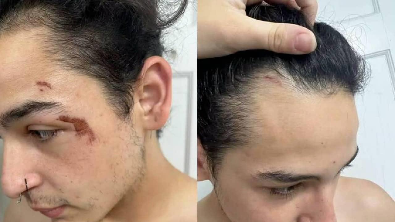 Hombre trans usa baño de mujeres, lo golpean y arrestan
