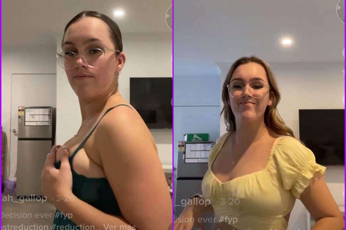 Joven se reduce los senos para evitar el acoso: "Me miraban con morbo, es repugnante" Joven se reduce los senos para evitar el acoso: "Me miraban con morbo, es repugnante"