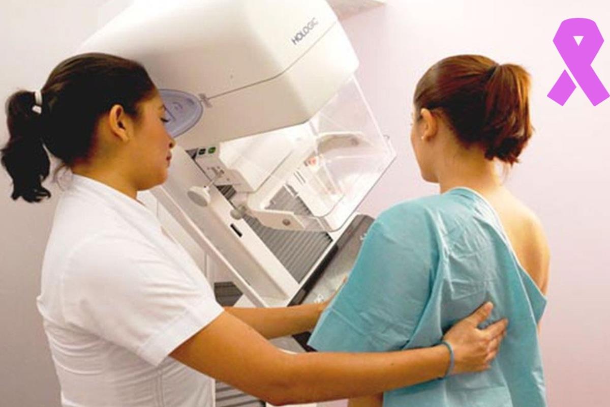 Mastografías gratuitas: ¿dónde realizarlas en la Ciudad de México?
