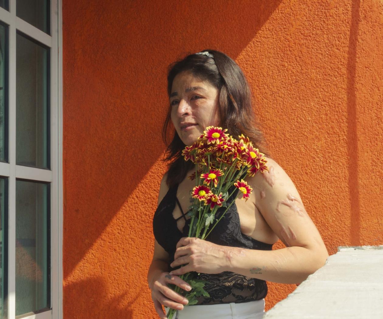 Sobrevivientes de violencia ácida exigen empleos dignos Sobrevivientes de violencia ácida exigen empleos dignos