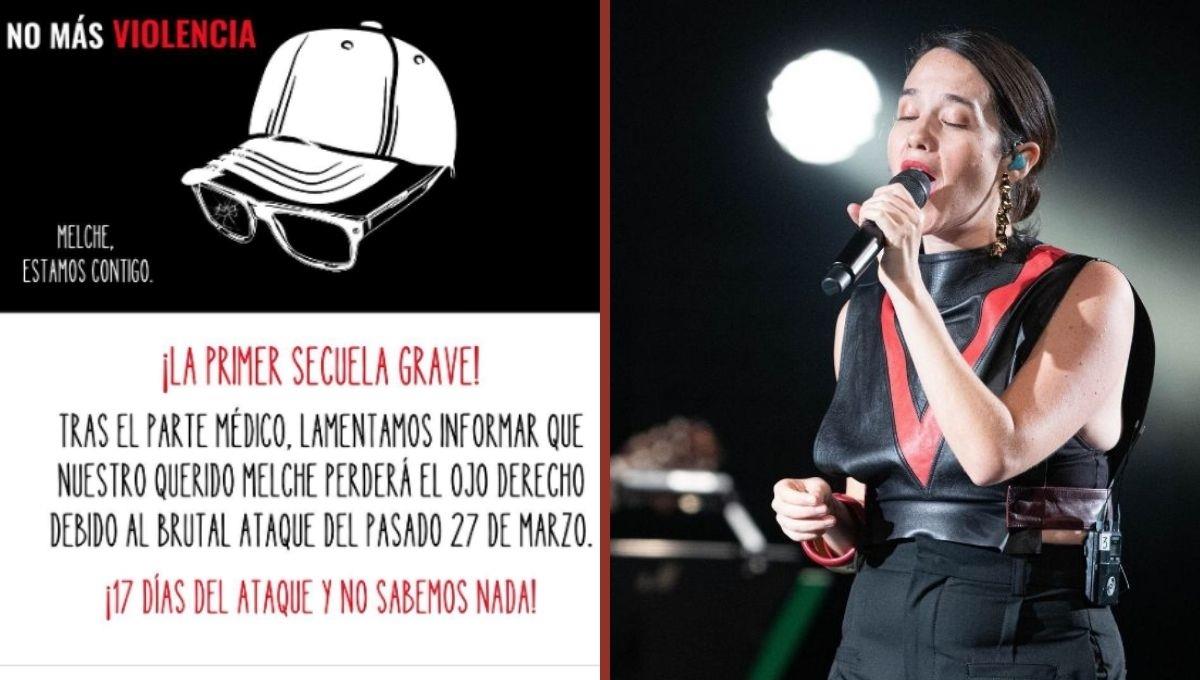 Manager de Ximena Sariñana perderá su ojo derecho tras ataque en la Feria del Caballo Manager de Ximena Sariñana perderá su ojo derecho tras ataque en la Feria del Caballo