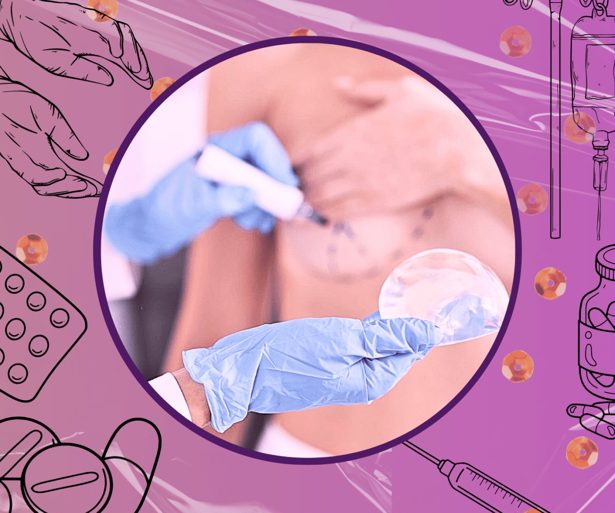 Cuando la cirugía estética no sale bien: la lucha contra la revictimización Cuando la cirugía estética no sale bien: la lucha contra la revictimización