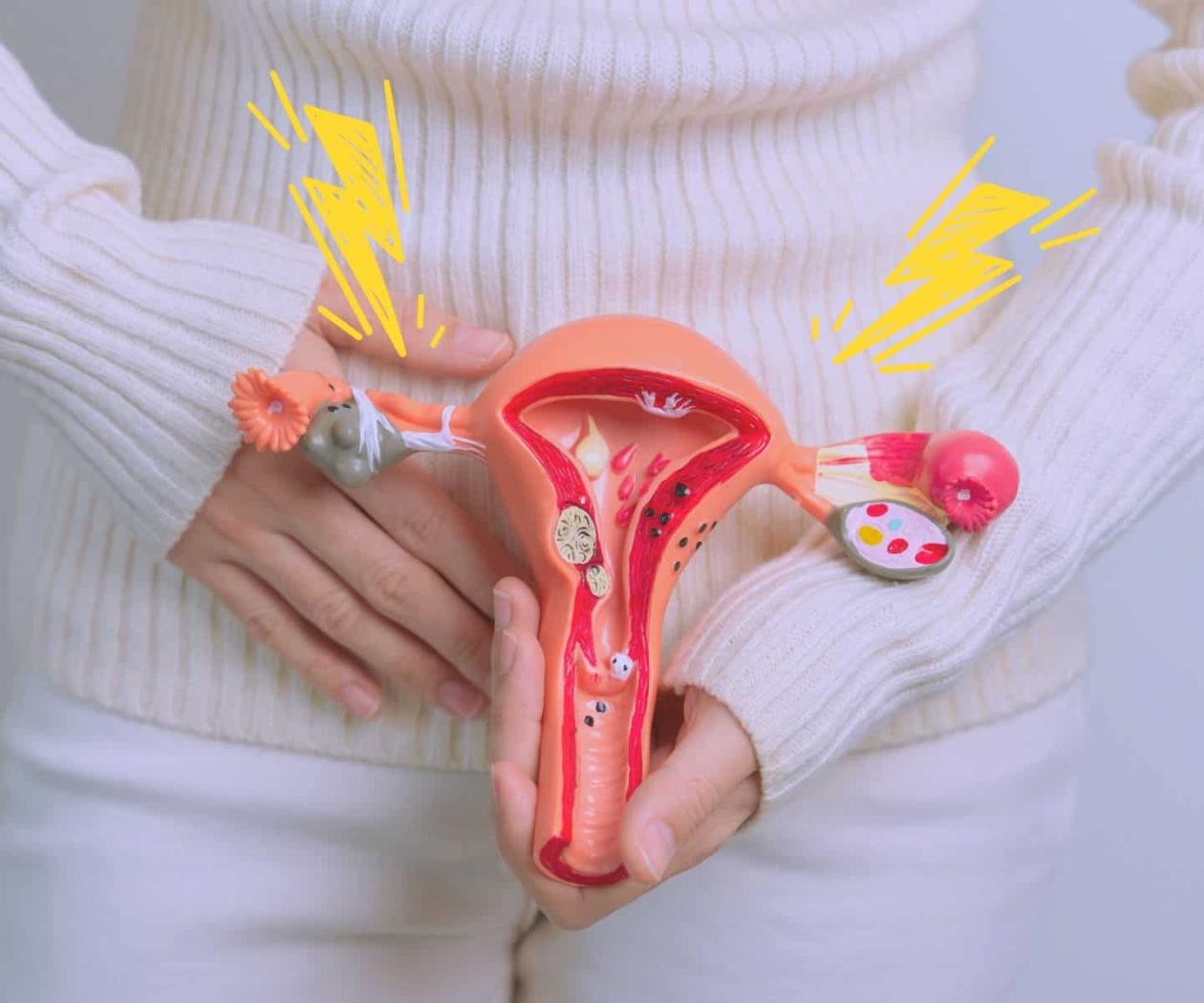 Endometriosis: Estas son las voces del dolor Endometriosis: Estas son las voces del dolor