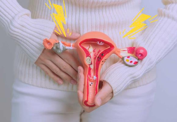 Endometriosis: Estas son las voces del dolor