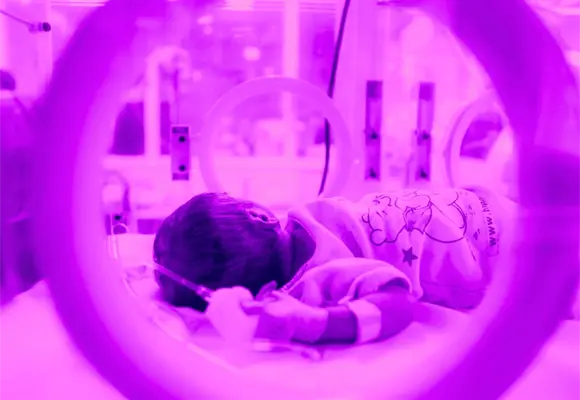 CNDH: IMSS viol&oacute; derechos de menor con desnutrici&oacute;n en Chihuahua