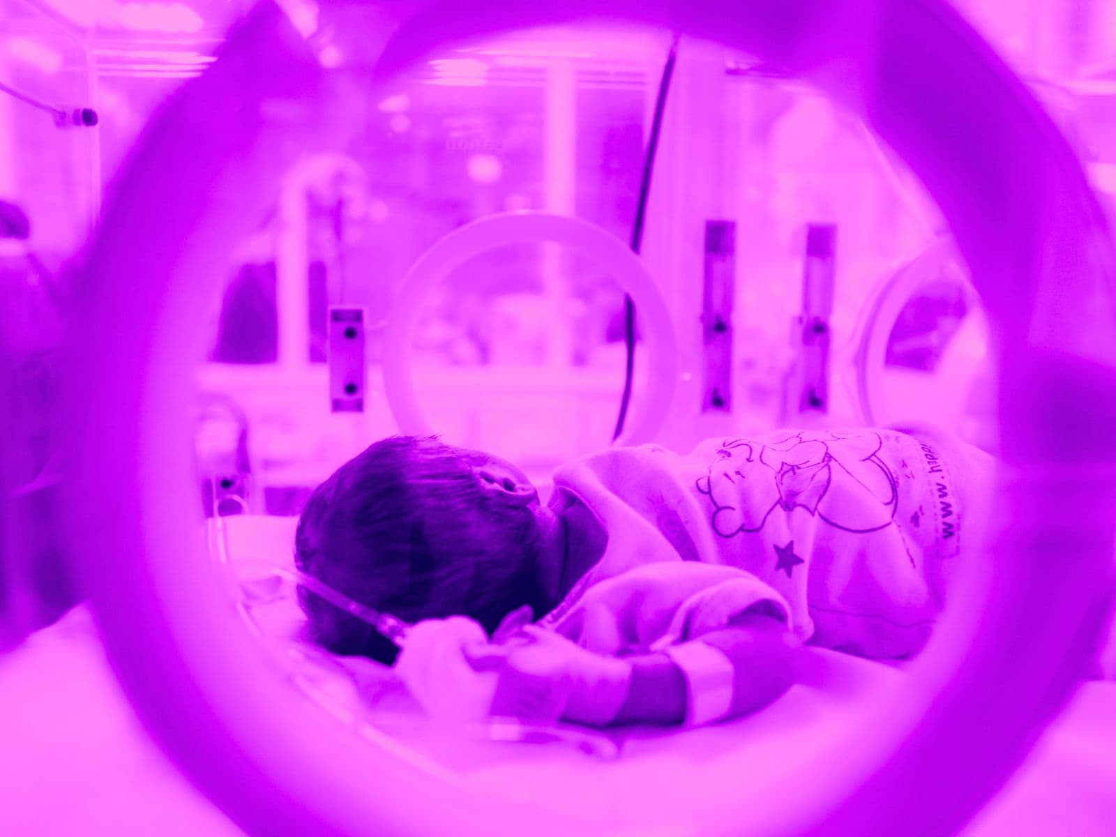 CNDH: IMSS violó derechos de menor con desnutrición en Chihuahua