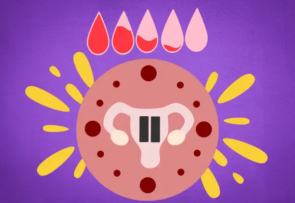 Menopausia, síntomas y cómo tratarlos