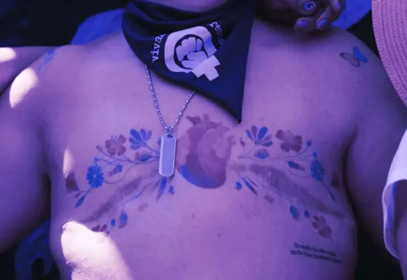 La violencia y el cáncer de mama: una intersección que demanda atención