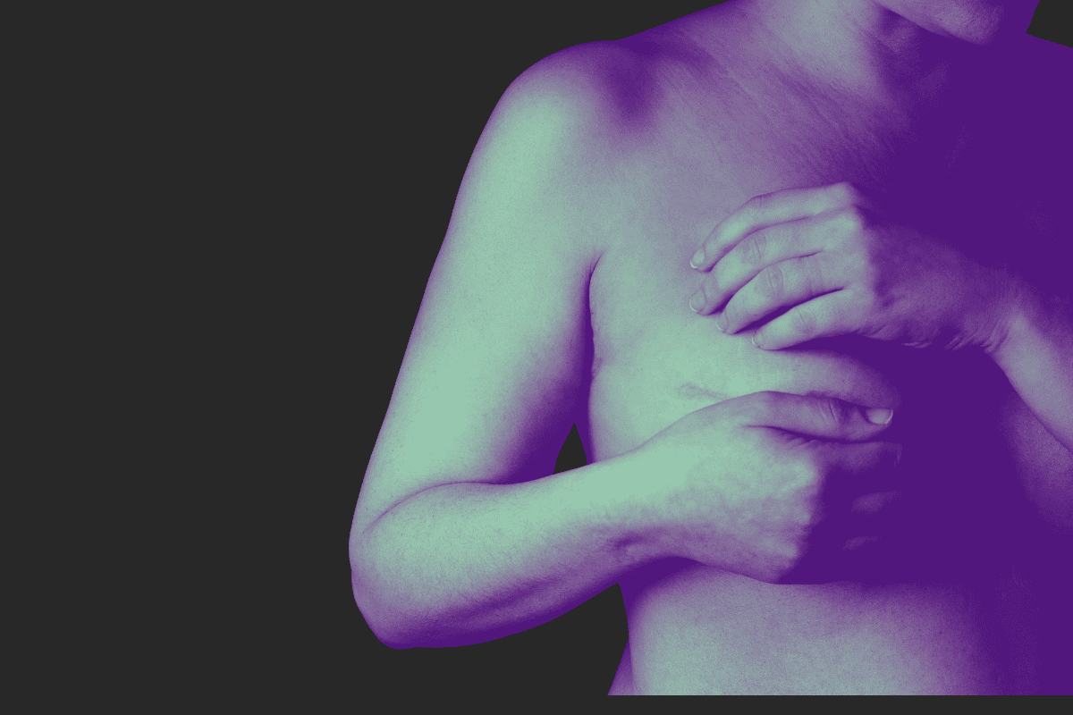 Depresión, la otra cara del cáncer de mama Depresión, la otra cara del cáncer de mama