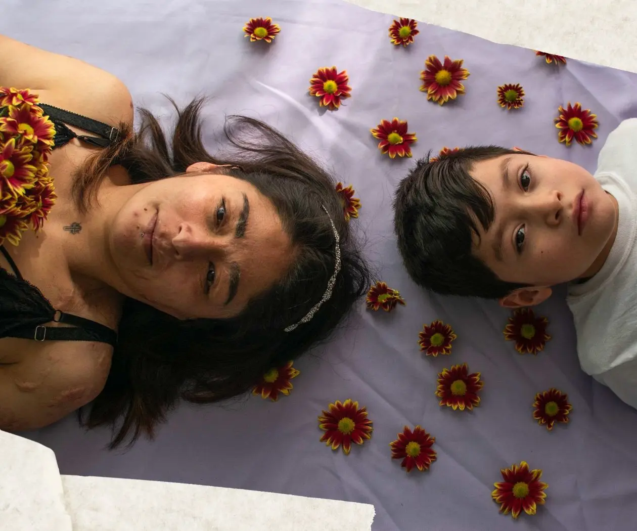 Cicatrices que florecen: la mirada sobre sobrevivientes de violencia ácida