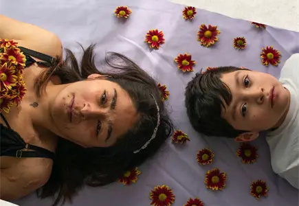 Cicatrices que florecen: la mirada sobre sobrevivientes de violencia &aacute;cida