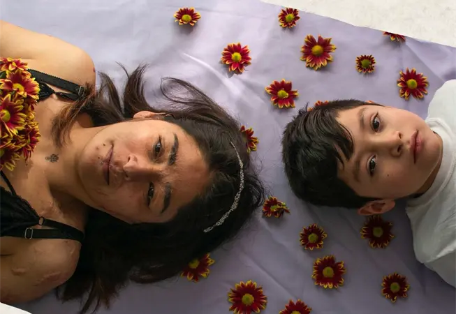 Cicatrices que florecen: la mirada sobre sobrevivientes de violencia &aacute;cida